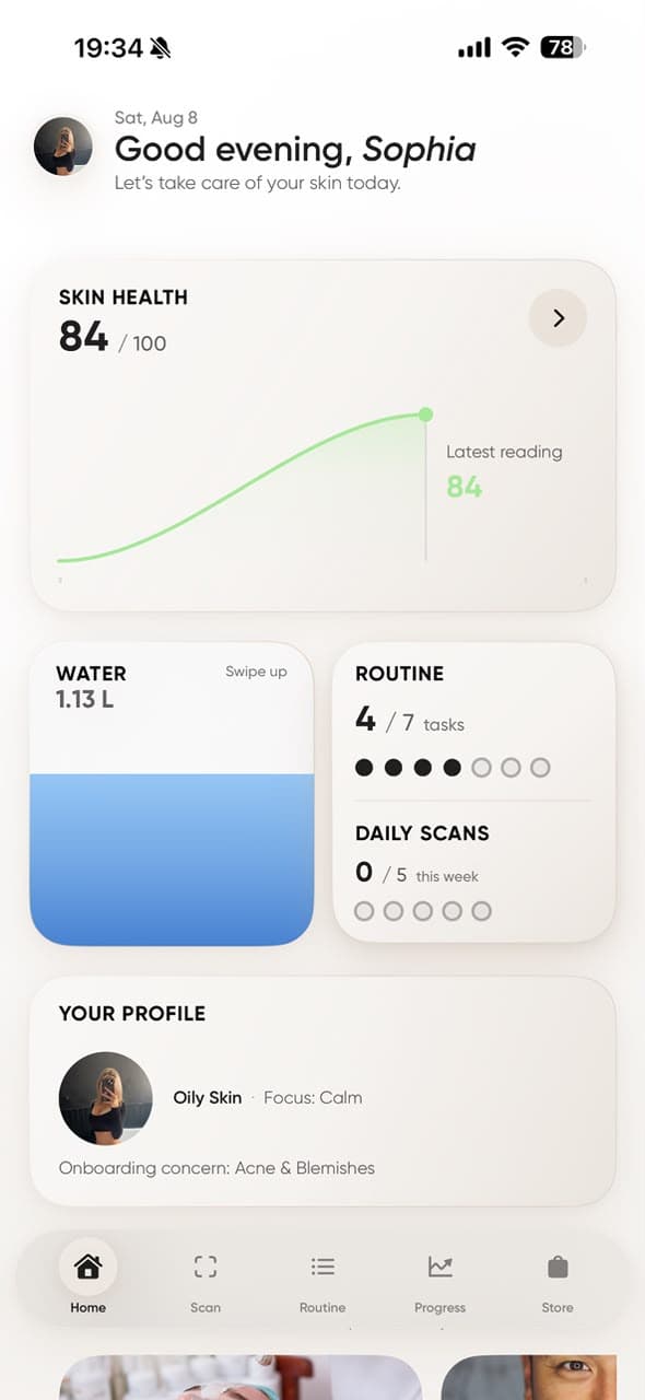 The CURA home screen: a skin health score of 84 out of 100 with a rising trend line, water and routine tracking cards, and a skin profile showing oily skin with an acne and blemishes focus.